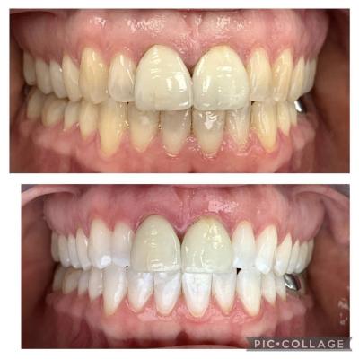 Before After Web 2